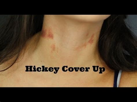 ways to cover up a hickey